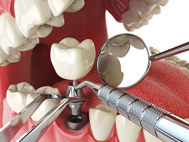 Best Walk-In Emergency Dentist in New Town, ND