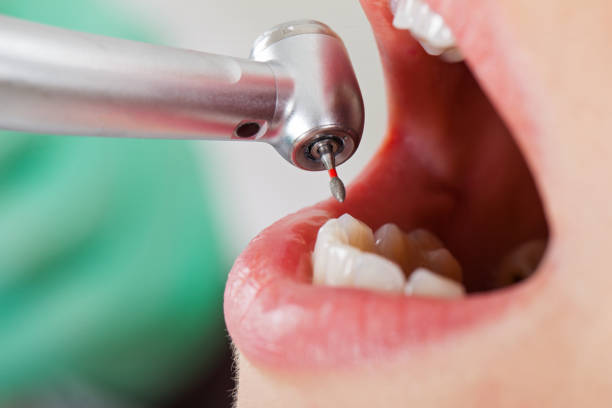 Best Walk-In Emergency Dentist in New Town, ND